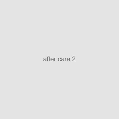after-cara-2 Lierac Sunissime Aftersun Rostro